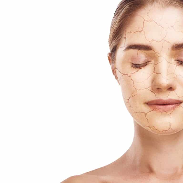 Bioresonanztherapie bei Hautproblemen